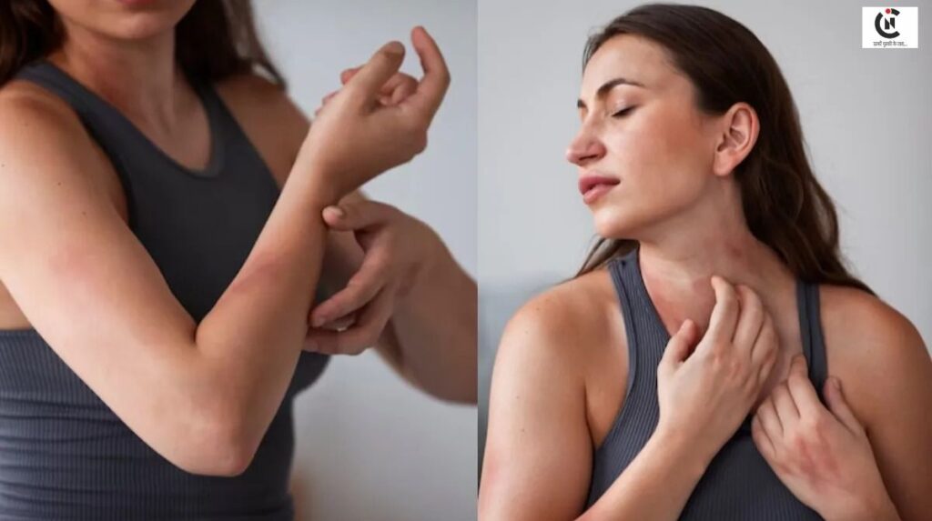 vitamin deficiency and itching remedies